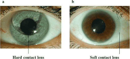 Clear Vision Unveiled: How Do Contact Lenses Work?